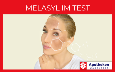 Melasyl – Was hilft bei Pigmentflecken?